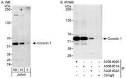 Detection of human Coronin 1 by western blot and immunoprecipitation.