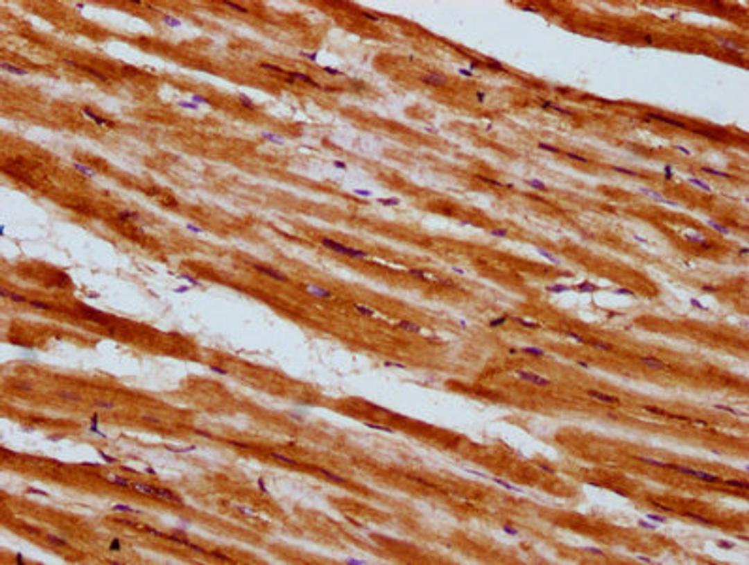 IHC image of CSB-PA624015LA01HU diluted at 1:300 and staining in paraffin-embedded human heart tissue performed on a Leica BondTM system. After dewaxing and hydration, antigen retrieval was mediated by high pressure in a citrate buffer (pH 6.0). Section was blocked with 10% normal goat serum 30min at RT. Then primary antibody (1% BSA) was incubated at 4&deg;C overnight. The primary is detected by a biotinylated secondary antibody and visualized using an HRP conjugated SP system.