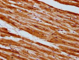 IHC image of CSB-PA624015LA01HU diluted at 1:300 and staining in paraffin-embedded human heart tissue performed on a Leica BondTM system. After dewaxing and hydration, antigen retrieval was mediated by high pressure in a citrate buffer (pH 6.0). Section was blocked with 10% normal goat serum 30min at RT. Then primary antibody (1% BSA) was incubated at 4&deg;C overnight. The primary is detected by a biotinylated secondary antibody and visualized using an HRP conjugated SP system.