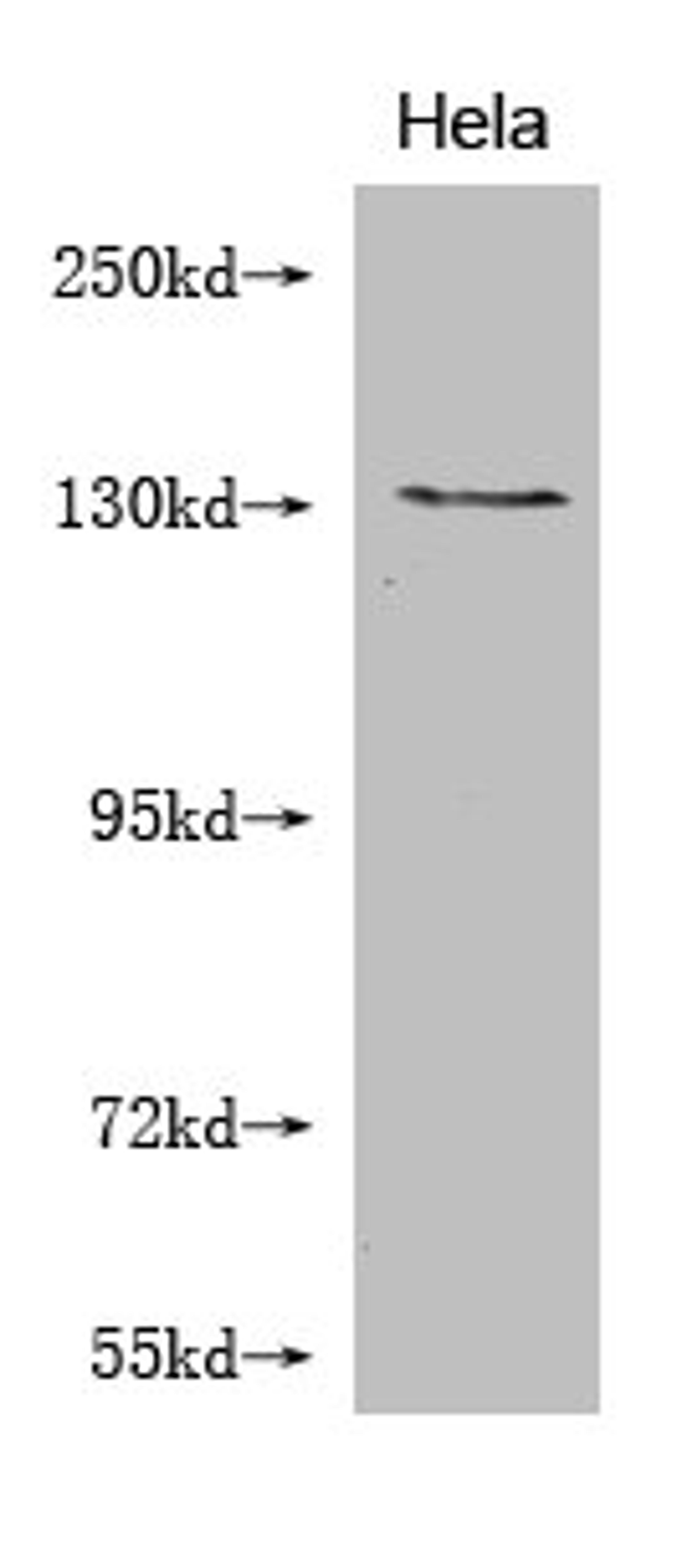 Western Blot. Positive WB detected in: Hela whole cell lysate . All lanes: NOS2 antibody at 1:2000. Secondary. Goat polyclonal to mouse IgG at 1/50000 dilution. Predicted band size: 131, 127 kDa. Observed band size: 131 KDa. Exposure time:5min
