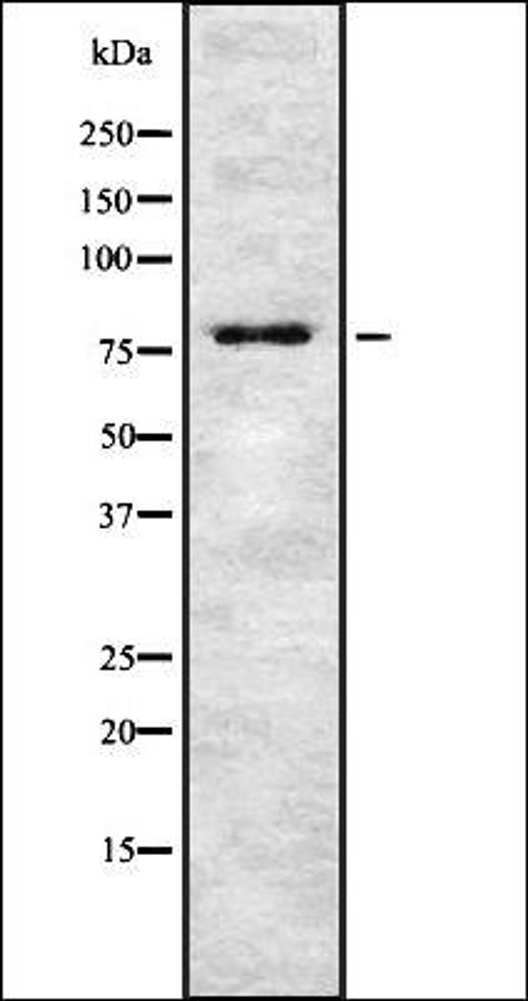 Western blot analysis of HEK293 cells using TSYL2 antibody