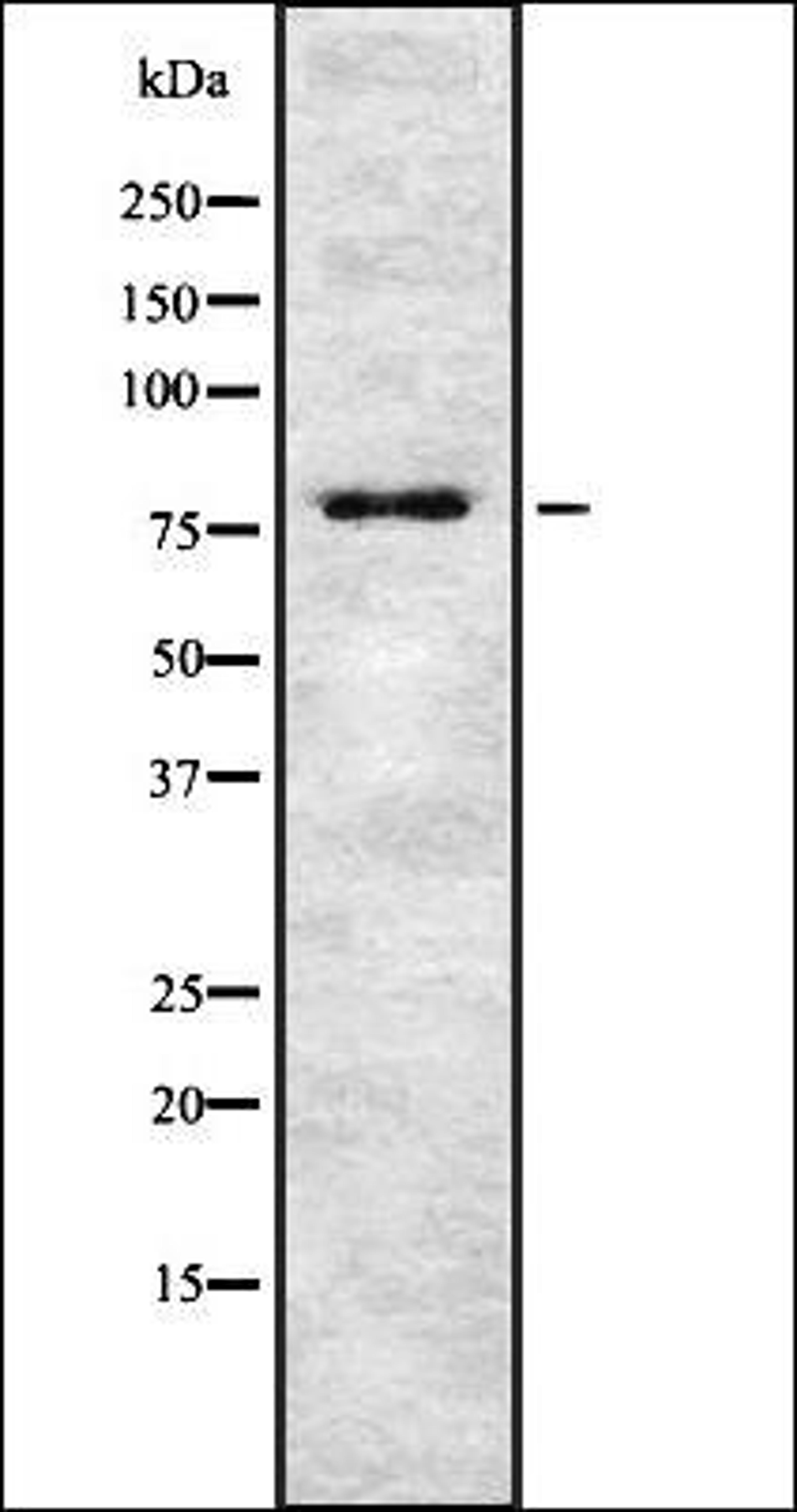 Western blot analysis of HEK293 cells using TSYL2 antibody