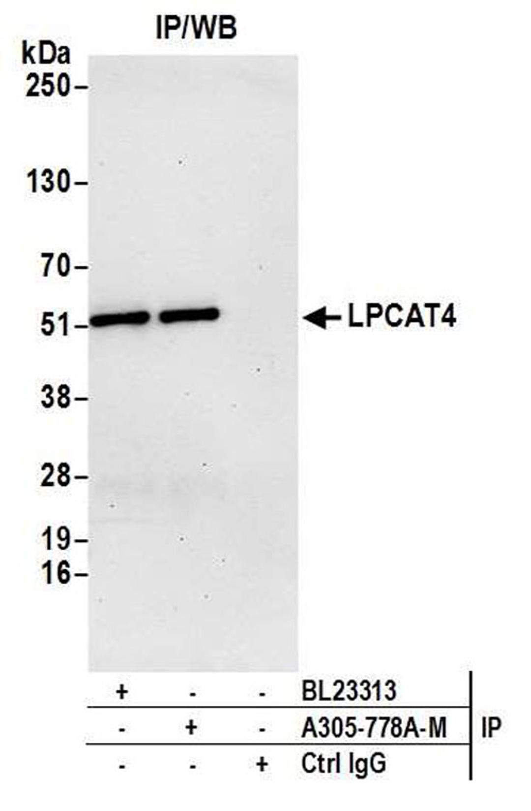 Detection of human LPCAT4 by WB of IP.