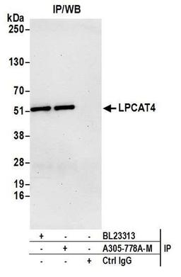 Detection of human LPCAT4 by WB of IP.