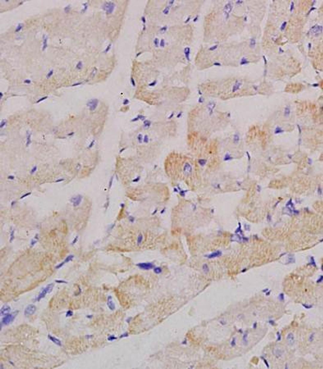 Immunohistochemical analysis of formalin fixed and paraffin embedded rat heart tissue using Factor V antibody 