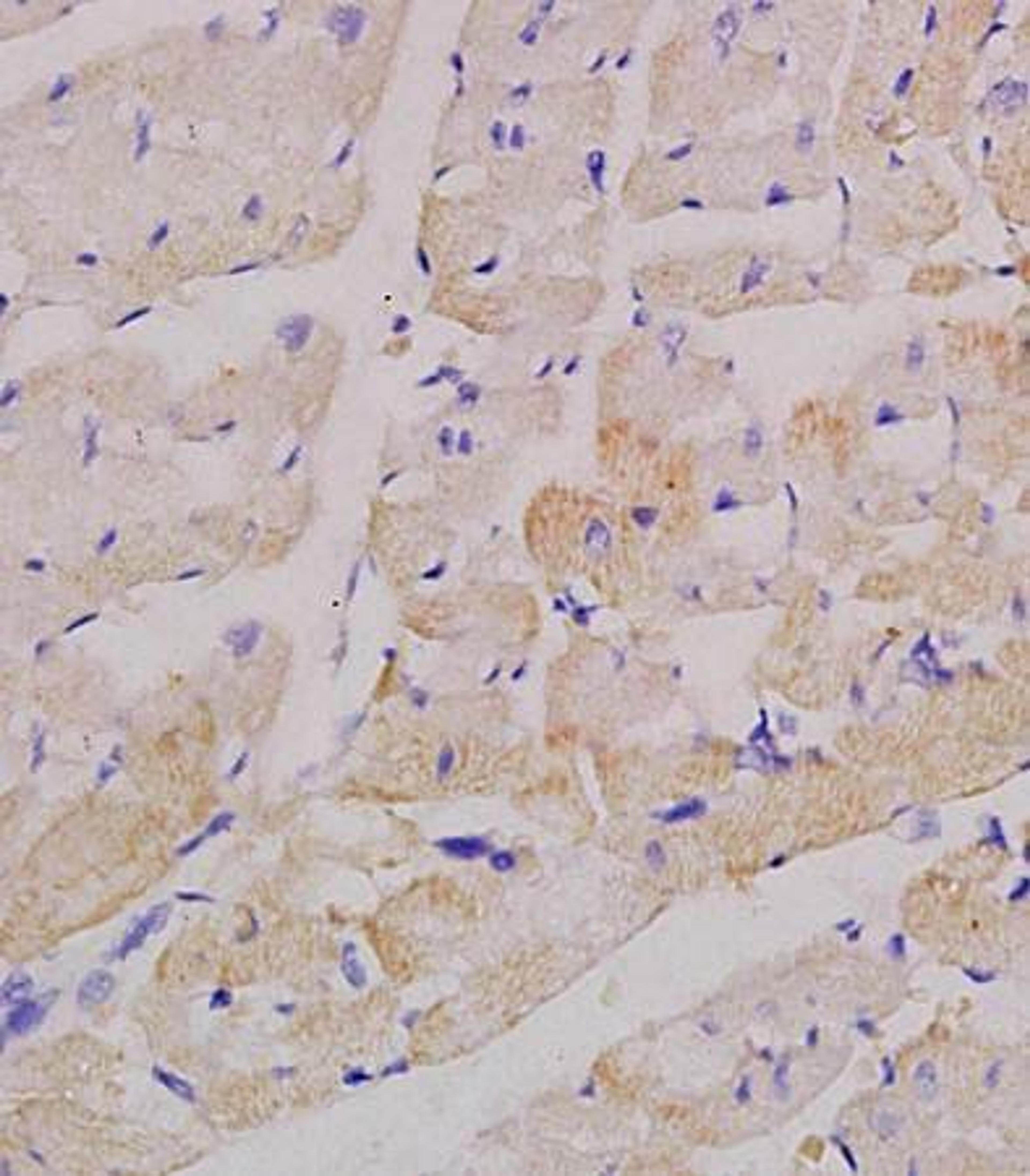 Immunohistochemical analysis of formalin fixed and paraffin embedded rat heart tissue using Factor V antibody