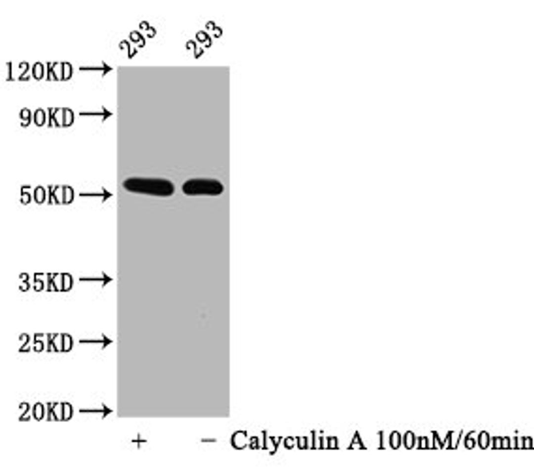 Western Blot. Positive WB detected in: 293 whole cell lysate(treated with Calyculin A or not). All lanes: Phospho-TP53 antibody at 0.64μg/ml. Secondary. Goat polyclonal to rabbit IgG at 1/50000 dilution. Predicted band size: 53 KDa. Observed band size: 53 KDa