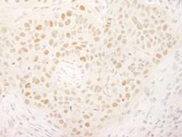 Detection of human KIFC1/MKLP2 by immunohistochemistry.