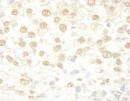 Immunohistochemistry-Paraffin: MLLT1 Antibody [NBP1-26653] - Section of human testicular seminoma.