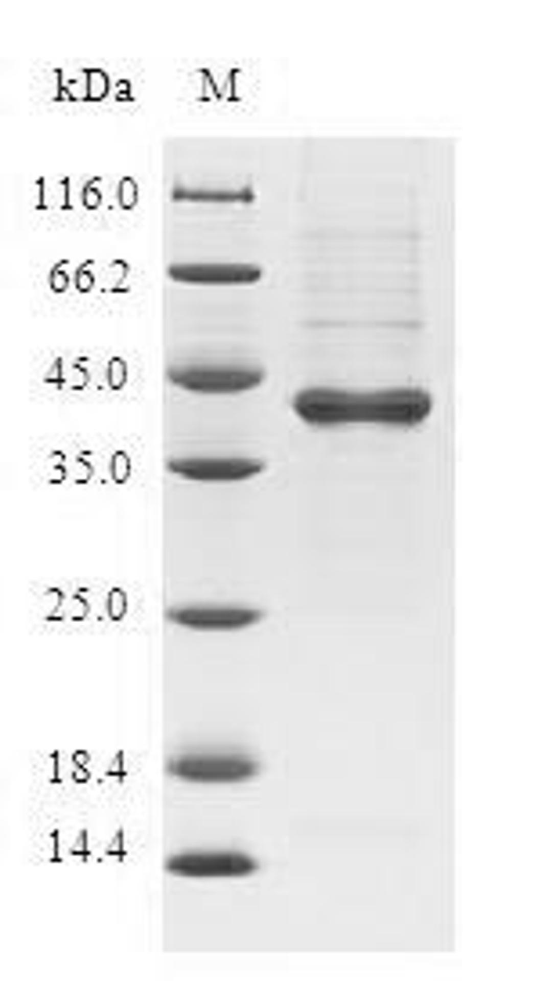 (Tris-Glycine gel) Discontinuous SDS-PAGE (reduced) with 5% enrichment gel and 15% separation gel.
