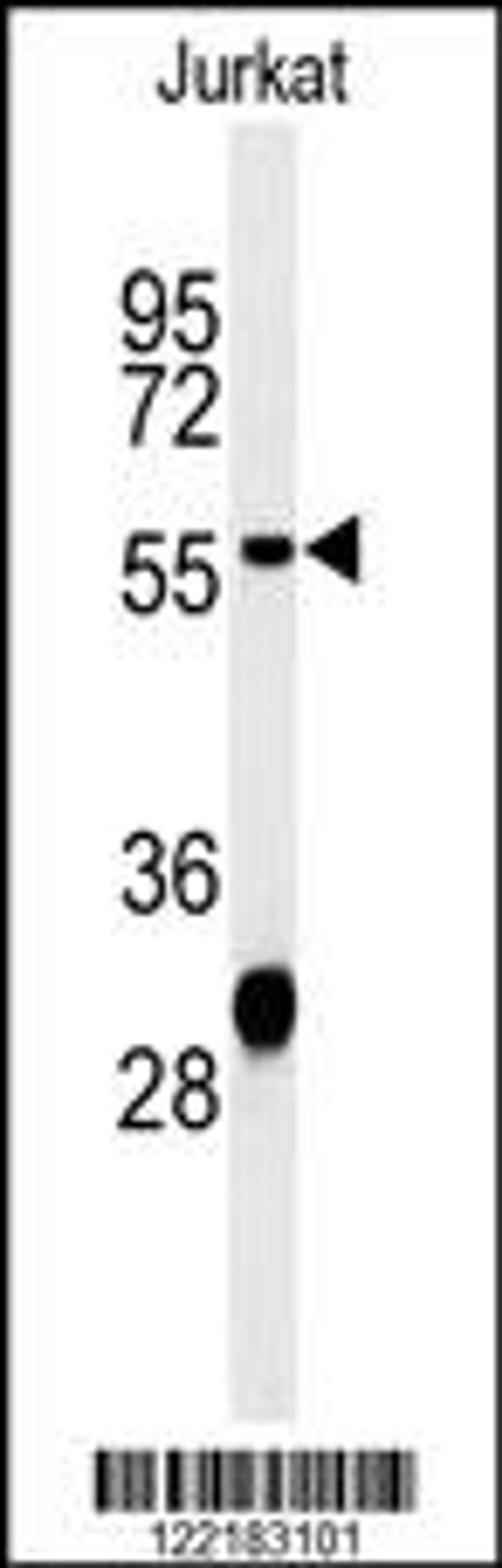 Western blot analysis of HADHB Antibody in Jurkat cell line lysates (35ug/lane)