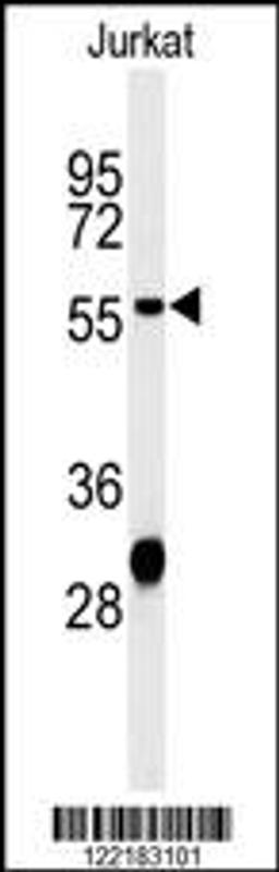 Western blot analysis of HADHB Antibody in Jurkat cell line lysates (35ug/lane)