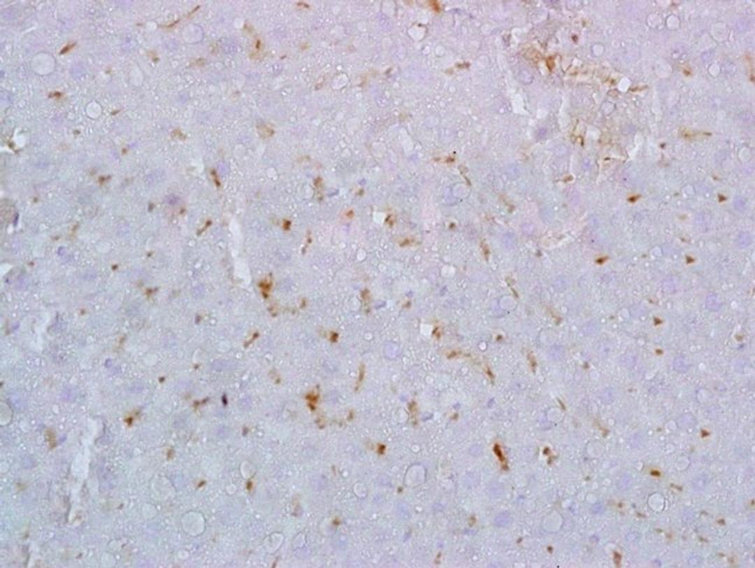 Immunohistochemical analysis of formalin fixed and paraffin embedded rat liver tissue using Galectin 9 antibody (dilution at  1:200)