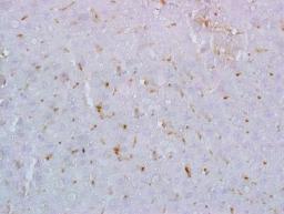 Immunohistochemical analysis of formalin fixed and paraffin embedded rat liver tissue using Galectin 9 antibody (dilution at  1:200)