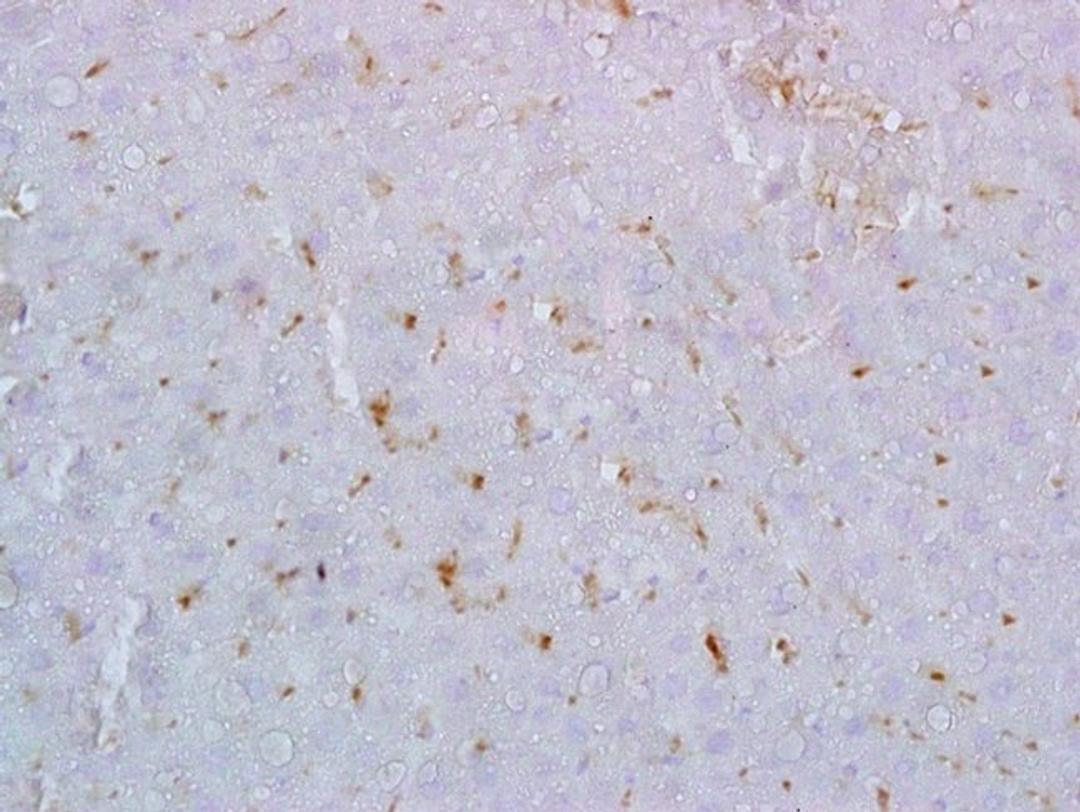 Immunohistochemical analysis of formalin fixed and paraffin embedded rat liver tissue using Galectin 9 antibody (dilution at 1:200)