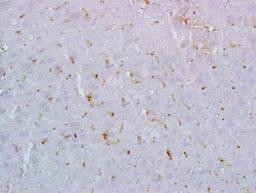 Immunohistochemical analysis of formalin fixed and paraffin embedded rat liver tissue using Galectin 9 antibody (dilution at 1:200)