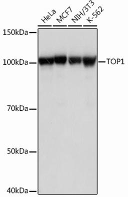 Western blot - TOP1 Rabbit mAb (A12409)