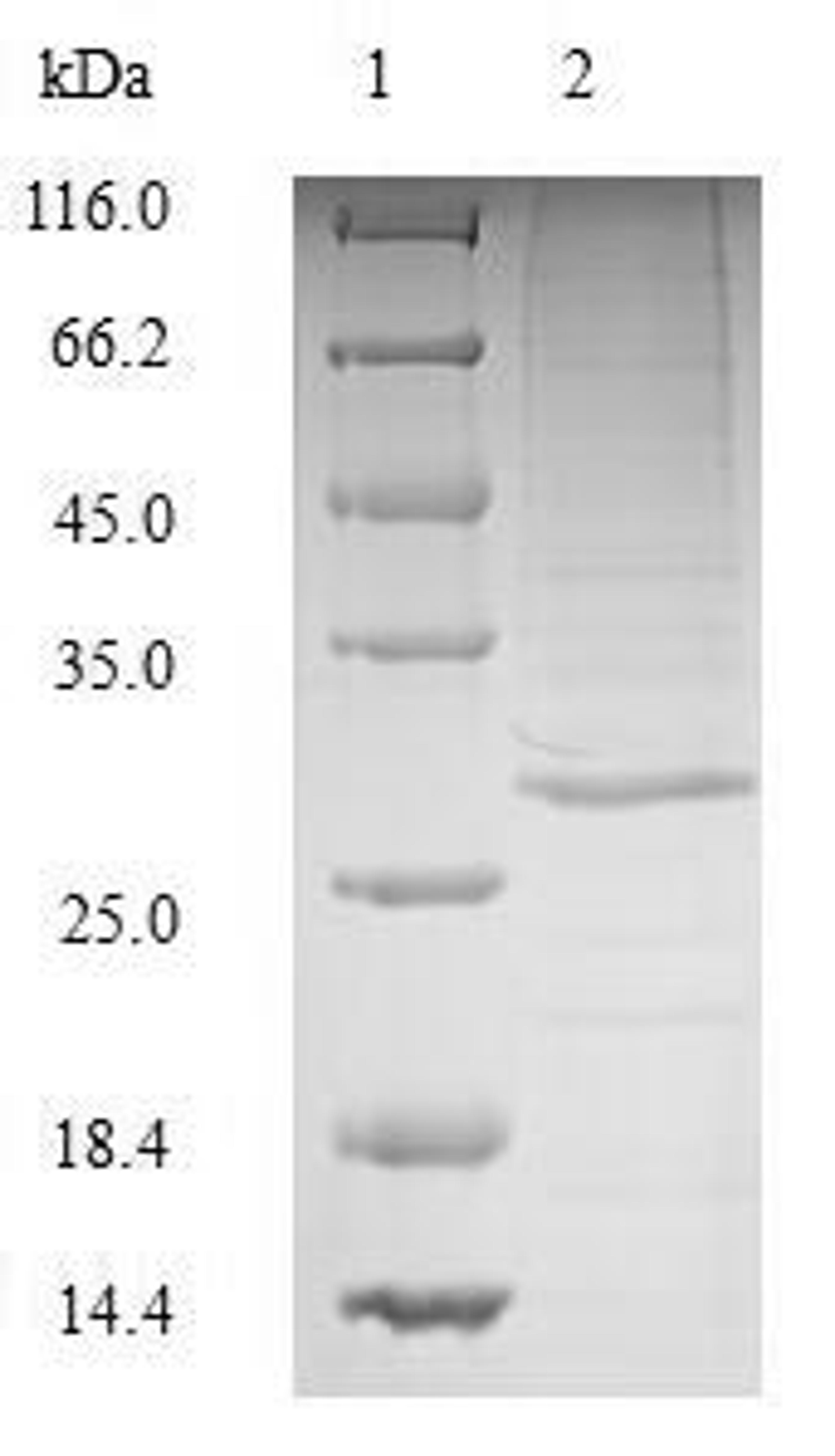 (Tris-Glycine gel) Discontinuous SDS-PAGE (reduced) with 5% enrichment gel and 15% separation gel.