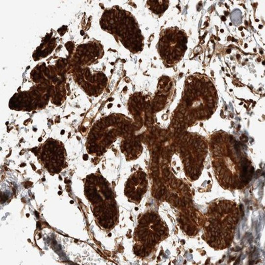 Immunohistochemistry-Paraffin: EXOC7 Antibody [NBP1-84767] - Staining of human breast shows strong cytoplasmic positivity in glandular cells.