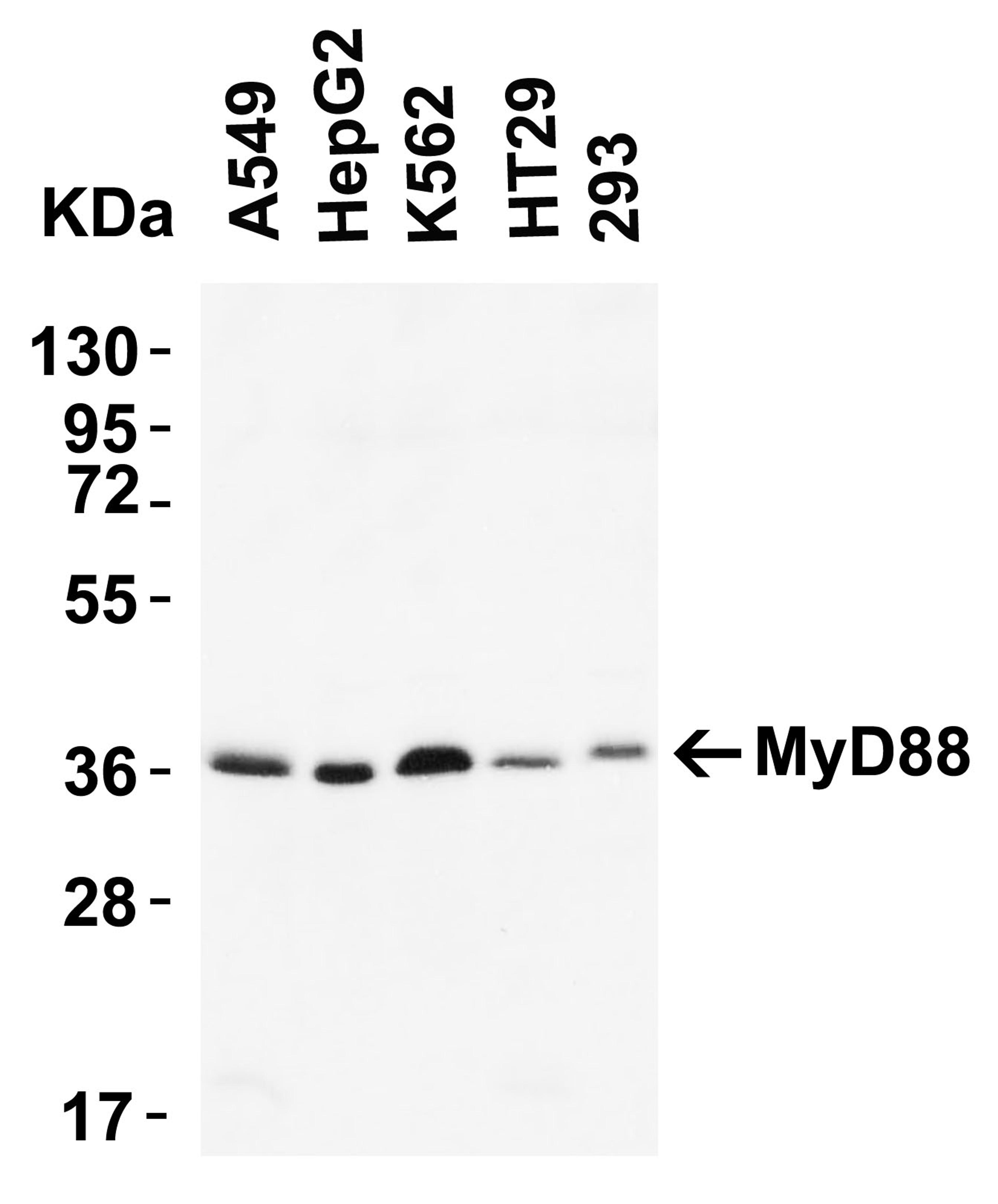<strong>Figure 1 Western Blot Validation of MyD88 in human cell lines</strong><br>
Loading: 15 μg of lysates per lane.
Antibodies: 2127 (2 μg/mL) 1 h incubation at RT in 5% NFDM/TBST.
Secondary: Goat anti-rabbit IgG HRP conjugate at 1:10000 dilu