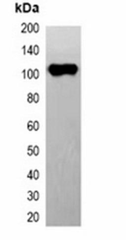 Western blot analysis of 293T cell lysate using EYFP-tag antibody