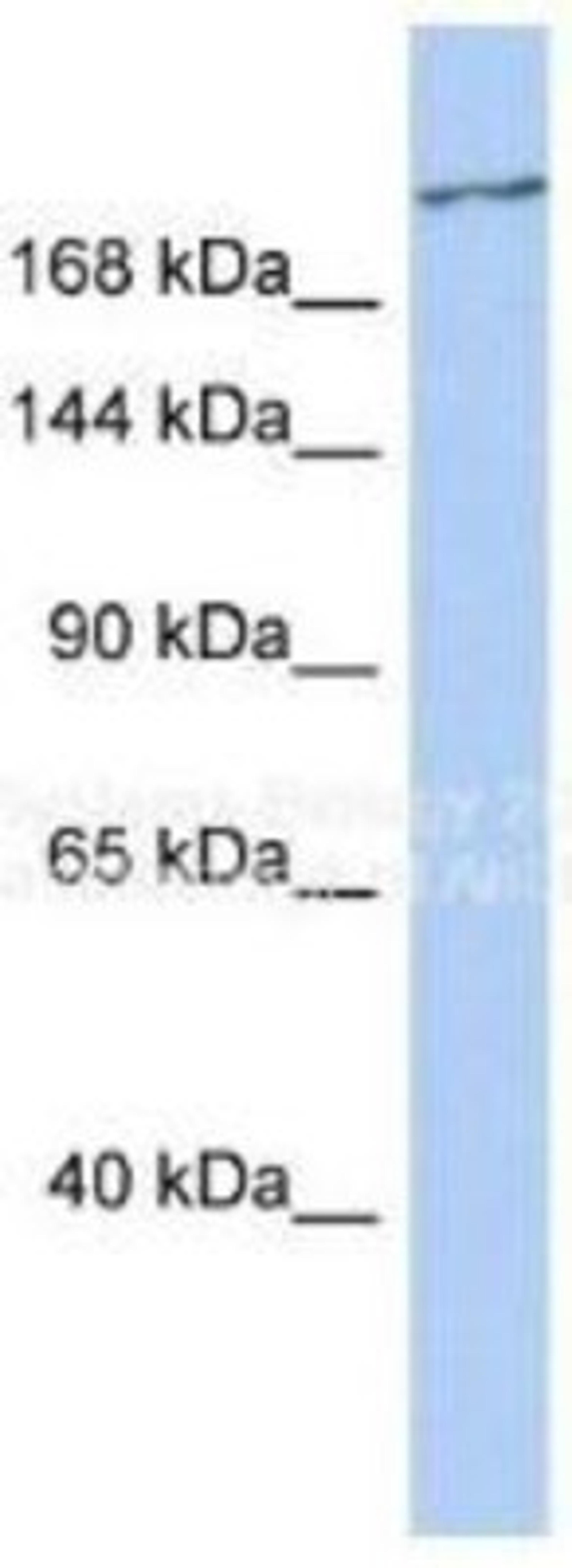 Western Blot: CACNA1G Antibody [NBP1-80105] - Titration: 0.2-1 ug/ml, Positive Control: Human Spleen.