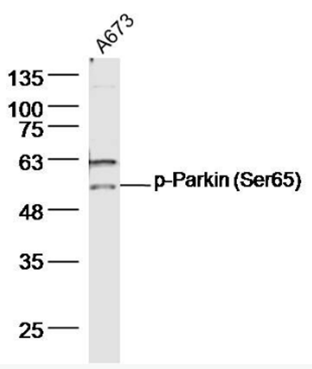 Western blot analysis of A673 Cell Lysate using Parkin antibody