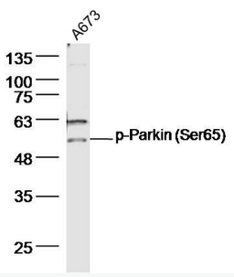 Western blot analysis of A673 Cell Lysate using Parkin antibody