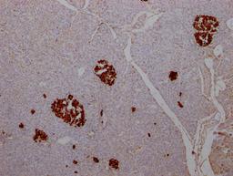 IHC image of CSB-RA584163A0HU diluted at 1:100 and staining in paraffin-embedded human pancreatic tissue performed on a Leica BondTM system. After dewaxing and hydration, antigen retrieval was mediated by high pressure in a citrate buffer (pH 6.0). Section was blocked with 10% normal goat serum 30min at RT. Then primary antibody (1% BSA) was incubated at 4℃ overnight. The primary is detected by a Goat anti-rabbit IgG polymer labeled by HRP and visualized using 0.05% DAB.