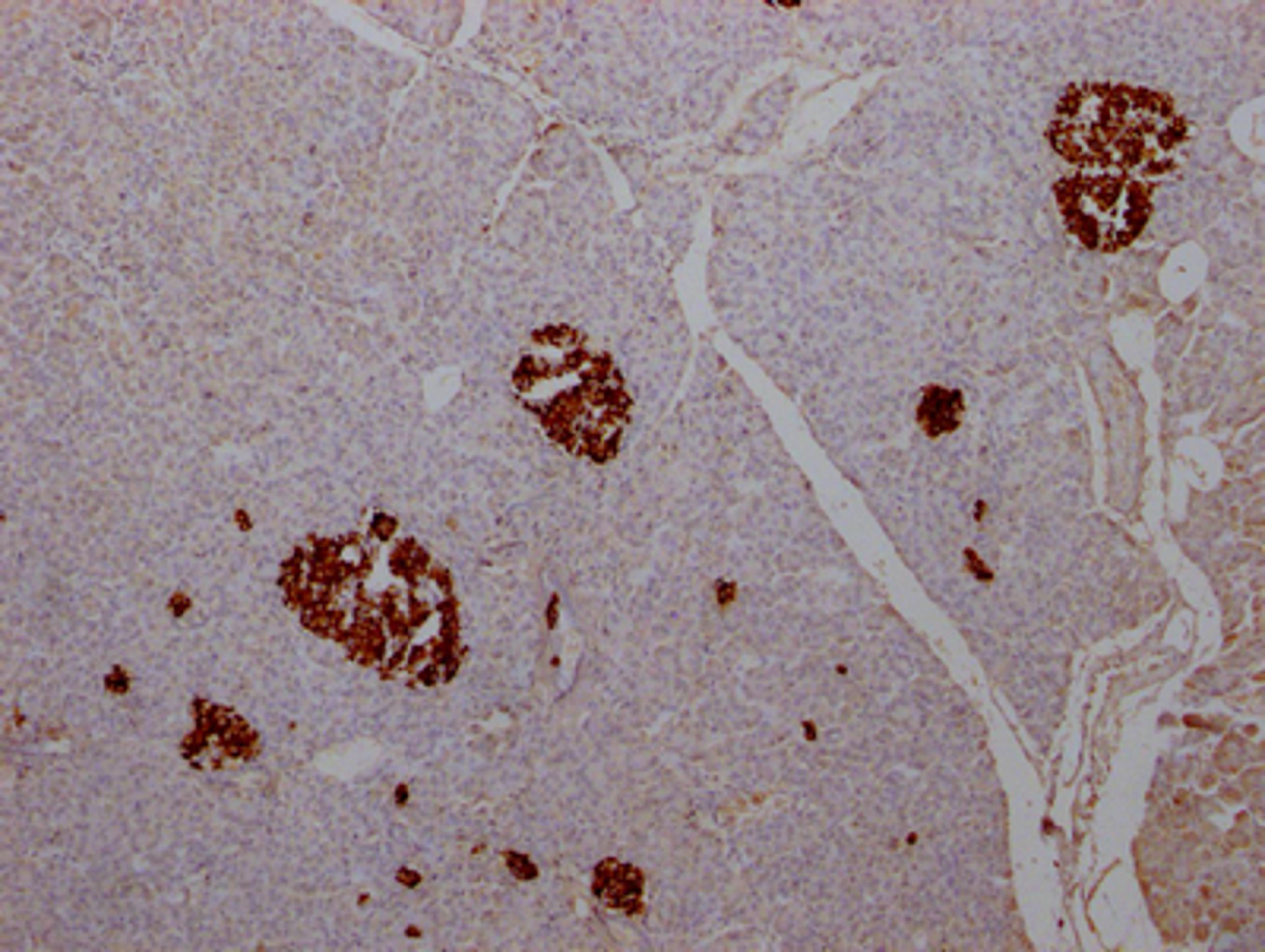IHC image of CSB-RA584163A0HU diluted at 1:100 and staining in paraffin-embedded human pancreatic tissue performed on a Leica BondTM system. After dewaxing and hydration, antigen retrieval was mediated by high pressure in a citrate buffer (pH 6.0). Section was blocked with 10% normal goat serum 30min at RT. Then primary antibody (1% BSA) was incubated at 4℃ overnight. The primary is detected by a Goat anti-rabbit IgG polymer labeled by HRP and visualized using 0.05% DAB.