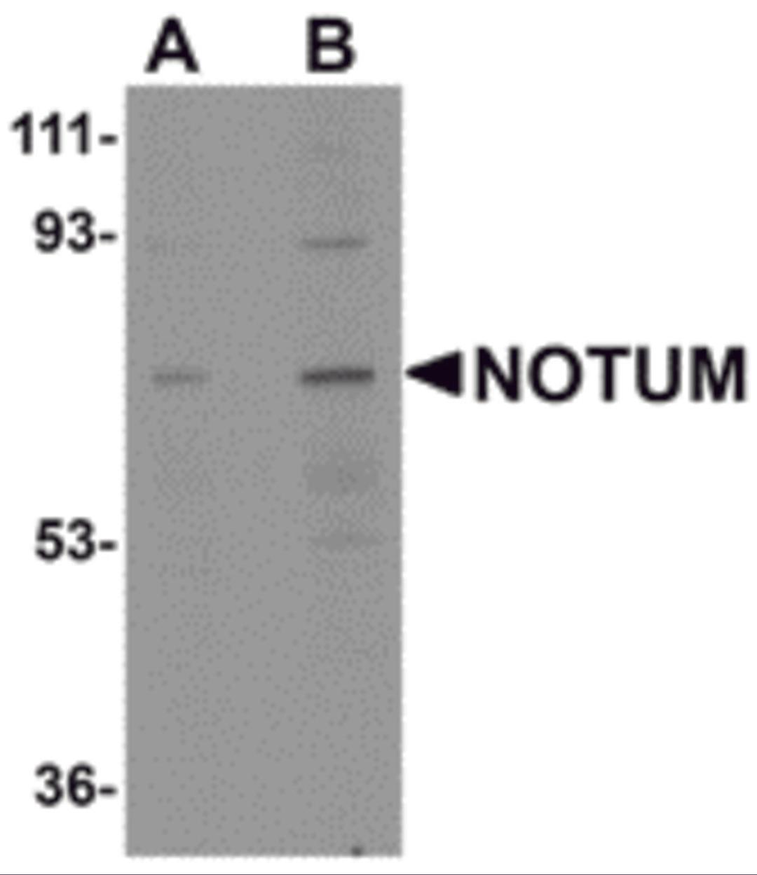 Western blot analysis of NOTUM in human kidney tissue lysate with NOTUM antibody at (A) 0.5 and (B) 1 &#956;g/mL.