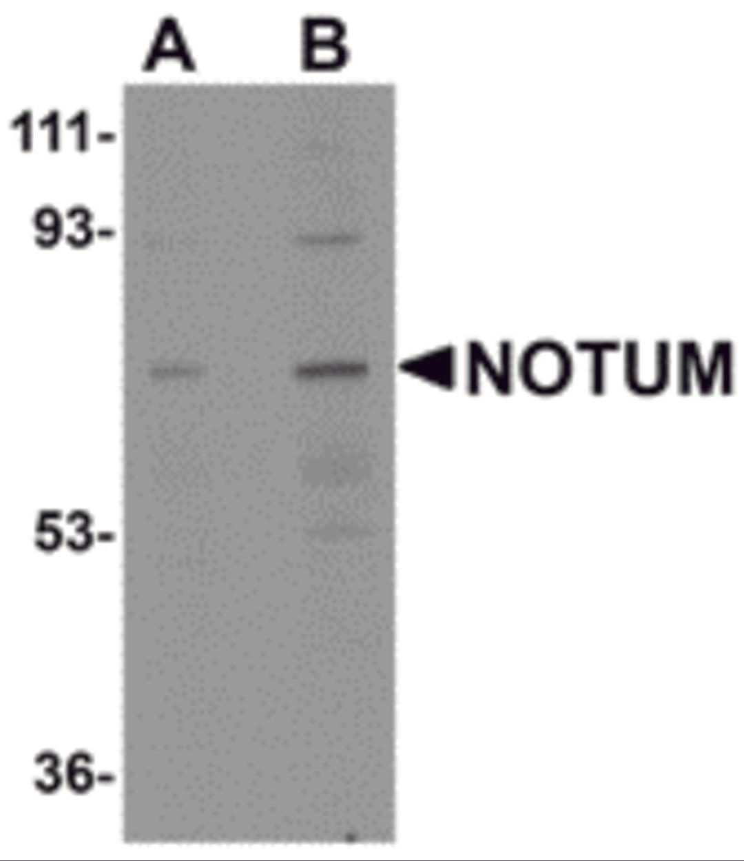Western blot analysis of NOTUM in human kidney tissue lysate with NOTUM antibody at (A) 0.5 and (B) 1 μg/mL.
