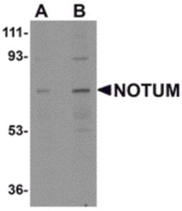 Western blot analysis of NOTUM in human kidney tissue lysate with NOTUM antibody at (A) 0.5 and (B) 1 μg/mL.