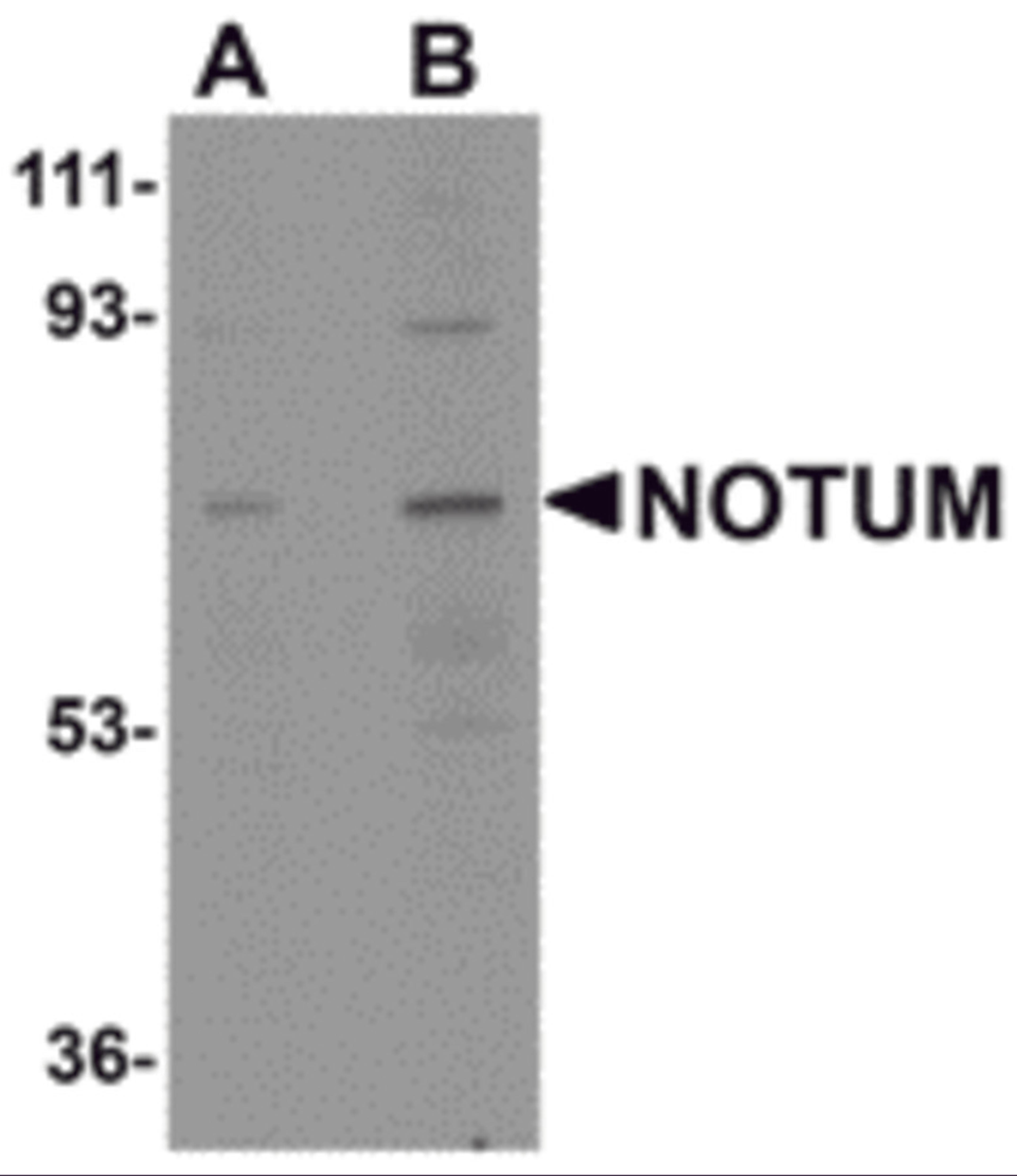 Western blot analysis of NOTUM in human kidney tissue lysate with NOTUM antibody at (A) 0.5 and (B) 1 μg/mL.