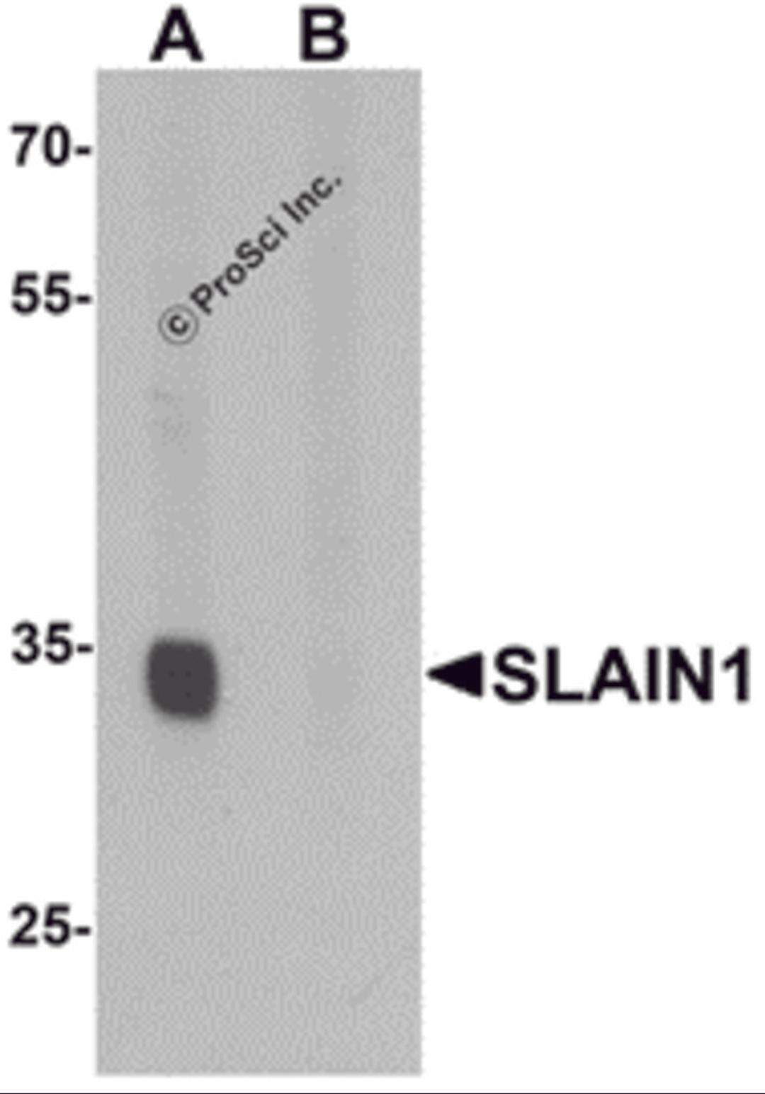 Western blot analysis of SLAIN1 in A549 cell lysate with SLAIN1 antibody at 1 μg/mL in (A) the absence and (B) the presence of blocking peptide.