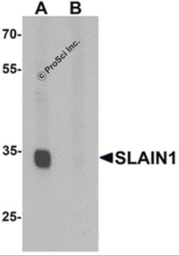 Western blot analysis of SLAIN1 in A549 cell lysate with SLAIN1 antibody at 1 μg/mL in (A) the absence and (B) the presence of blocking peptide.