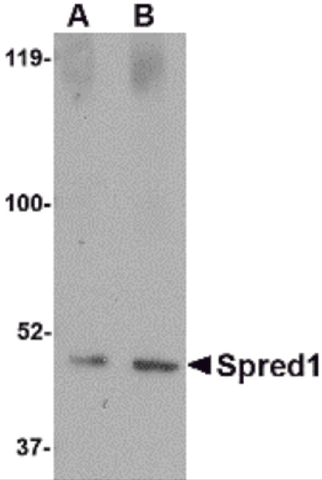 Western blot analysis of Spred1 in human brain tissue lysate with Spred1 antibody at (A) 1 and (B) 2 &#956;g/mL.