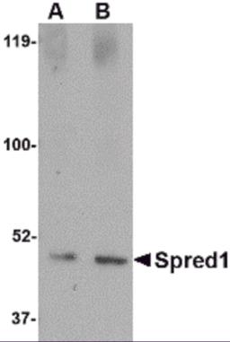 Western blot analysis of Spred1 in human brain tissue lysate with Spred1 antibody at (A) 1 and (B) 2 &#956;g/mL.