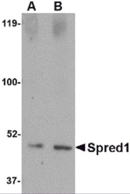 Western blot analysis of Spred1 in human brain tissue lysate with Spred1 antibody at (A) 1 and (B) 2 μg/mL.