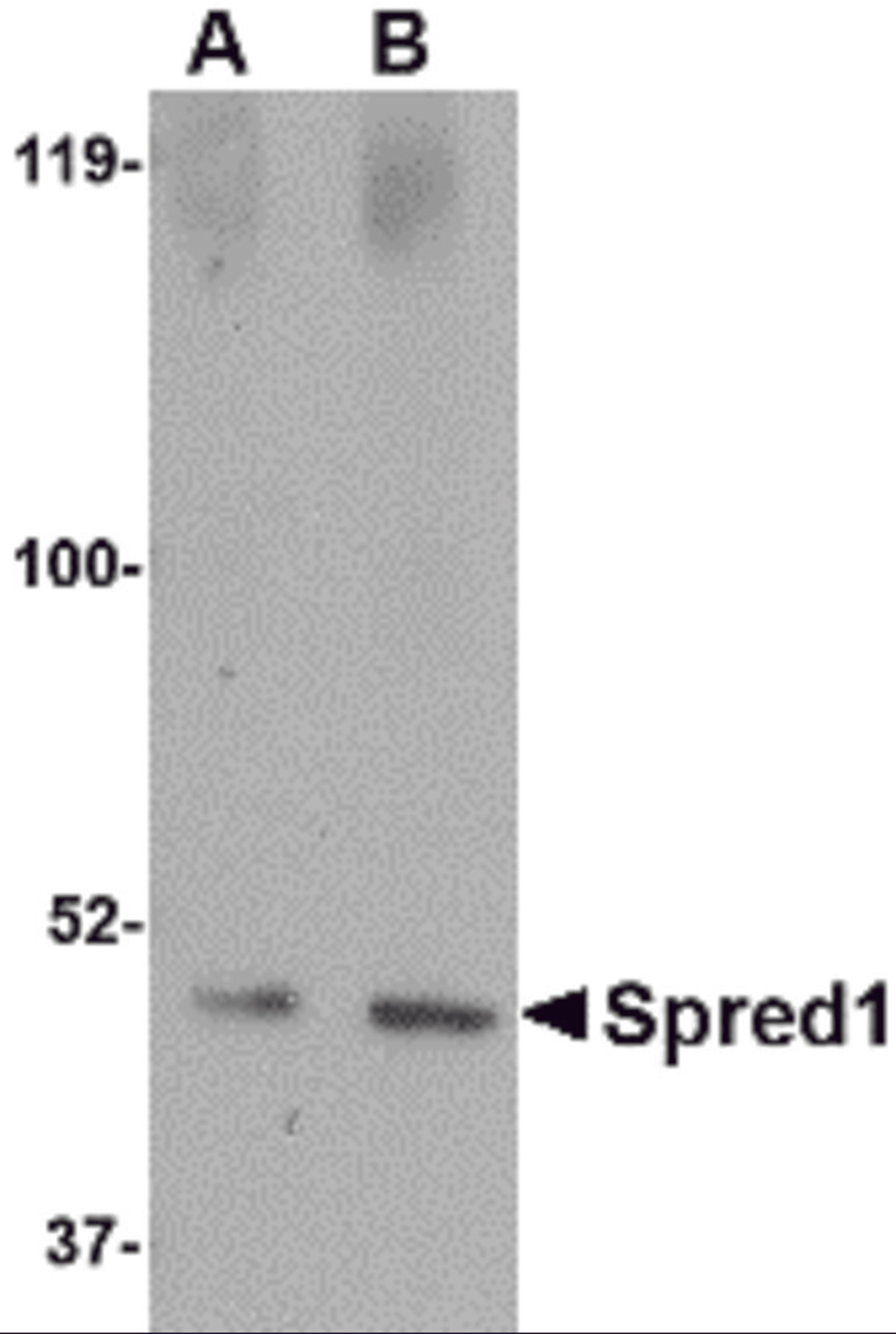 Western blot analysis of Spred1 in human brain tissue lysate with Spred1 antibody at (A) 1 and (B) 2 μg/mL.