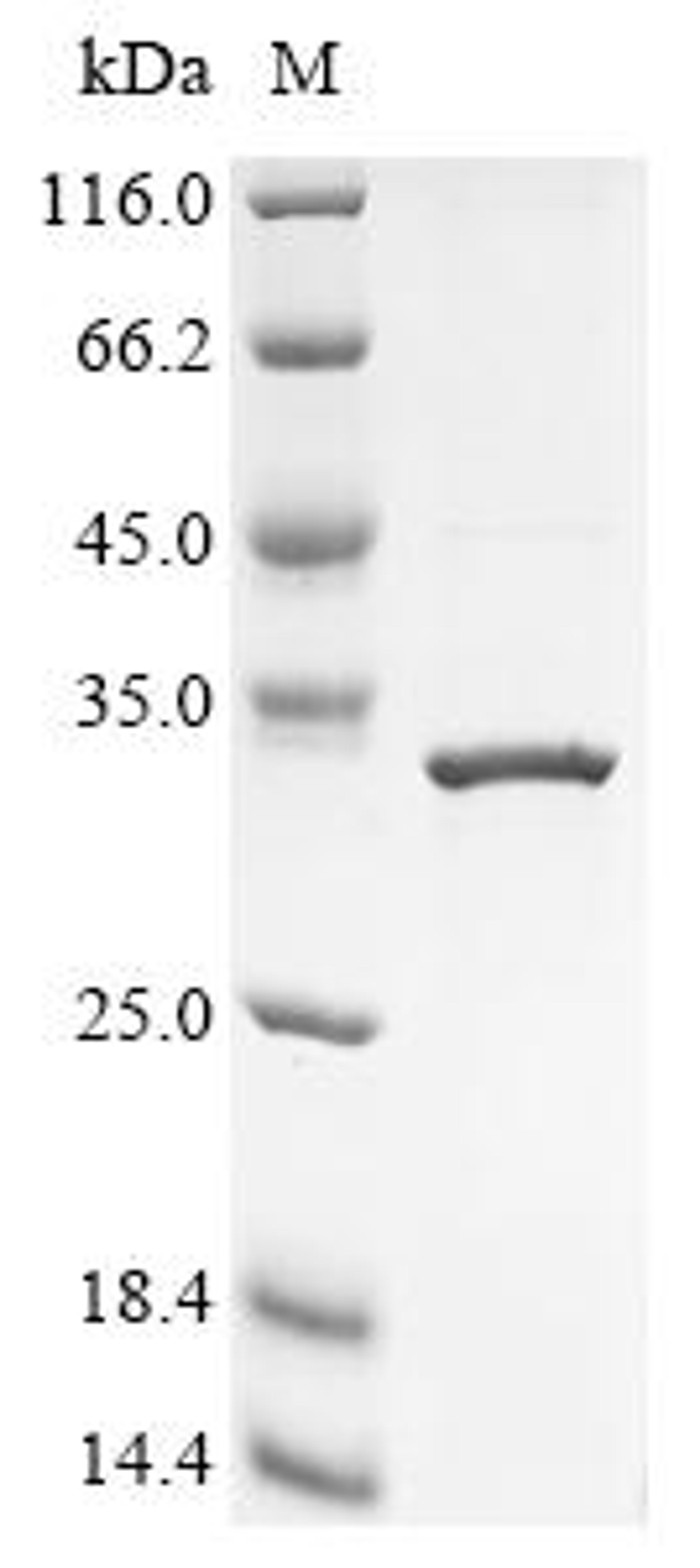 (Tris-Glycine gel) Discontinuous SDS-PAGE (reduced) with 5% enrichment gel and 15% separation gel.