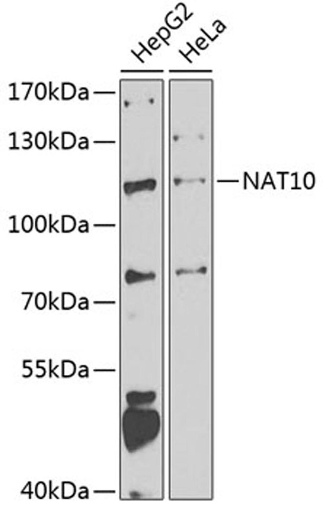 Western blot - NAT10 antibody (A7292)