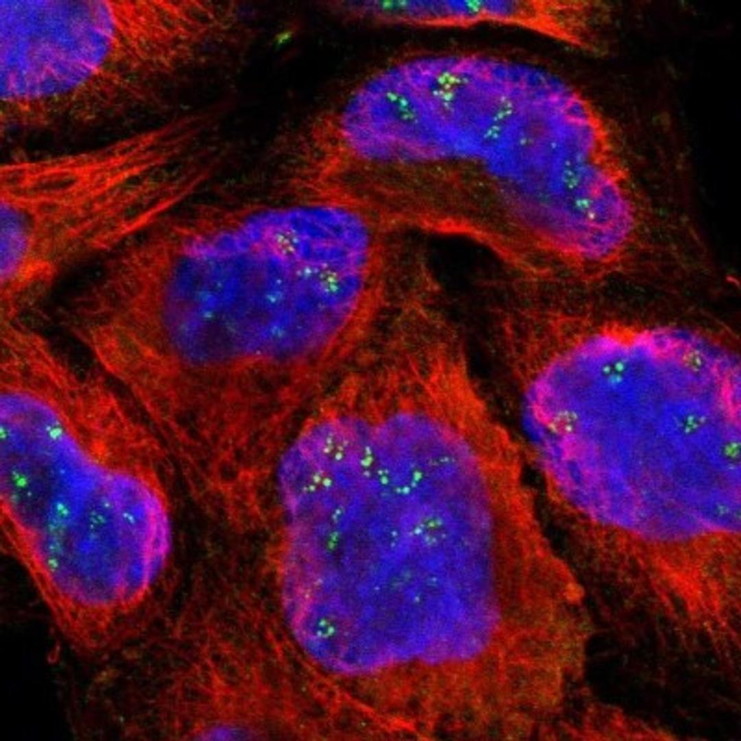 Immunocytochemistry/Immunofluorescence: ARHGEF7 Antibody [NBP1-88650] - Staining of human cell line A-431 shows positivity in nucleoli.