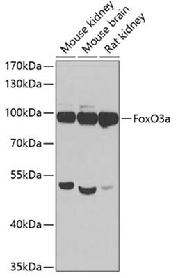 Western blot - FoxO3a  antibody (A0102)