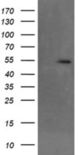 Western Blot: MKRN1 Antibody (2C8) [NBP2-45816] - Analysis of HEK293T cells were transfected with the pCMV6-ENTRY control (Left lane) or pCMV6-ENTRY MKRN1.