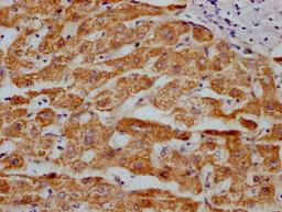 IHC image of CSB-RA250615A0HU diluted at 1:100 and staining in paraffin-embedded human liver tissue performed on a Leica BondTM system. After dewaxing and hydration, antigen retrieval was mediated by high pressure in a citrate buffer (pH 6.0). Section was blocked with 10% normal goat serum 30min at RT. Then primary antibody (1% BSA) was incubated at 4℃ overnight. The primary is detected by a Goat anti-rabbit IgG polymer labeled by HRP and visualized using 0.05% DAB.