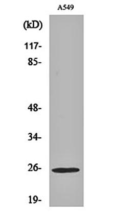 Western blot analysis of A549 cell lysates using Rho GDI gamma antibody