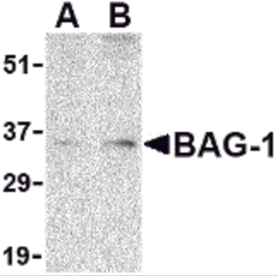 Western blot analysis of BAG-1 in PC-3 cell lysate with BAG-1 antibody at (A) 1 and (B) 2 &#956;g/mL.