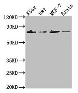 Western Blot. Positive WB detected in: K562 whole cell lysate, U87 whole cell lysate, MCF-7 whole cell lysate, Rat brain tissue. All lanes: LMNA antibody at 1:2000. Secondary. Goat polyclonal to rabbit IgG at 1/50000 dilution. Predicted band size: 75, 66, 71, 64, 63, 70 kDa. Observed band size: 75 kDa. 