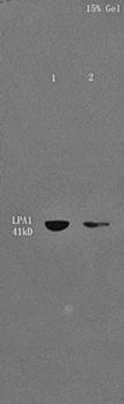 Western blot analysis of Mouse liver lysates (Lane1), Mouse cerebrum lysates (Lane2) dilution at:1:300 using EDG2 antibody